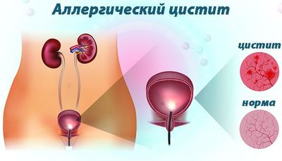 глубокий анамнез
