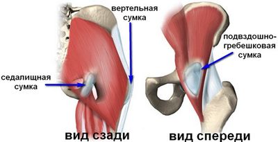 Симптомы бурсита тазобедренного сустава и способы его лечения