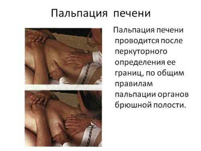 Пальпация печени