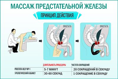 Что дает массаж предстательной железы?