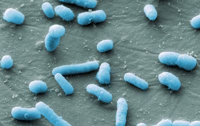 Escherichia coli (E. coli)