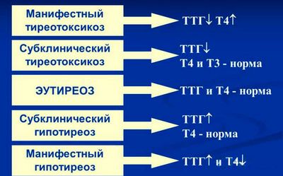 гипофункция щитовидки