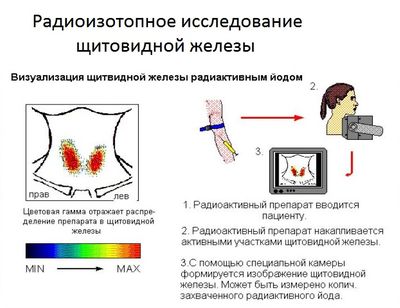 радиоизотопное сканирование
