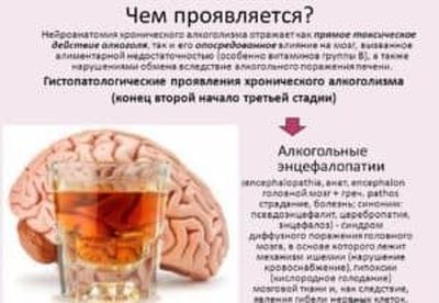 Симптомы алкогольной энцефалопатии