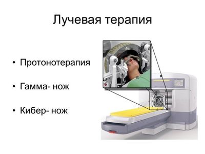 Лучевая терапия