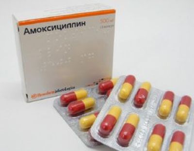 Антибиотики при ангине