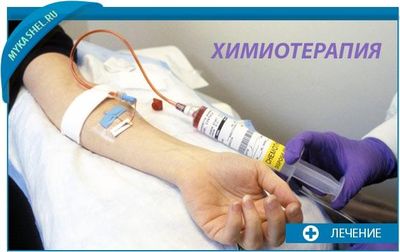 химиотерапия при раке