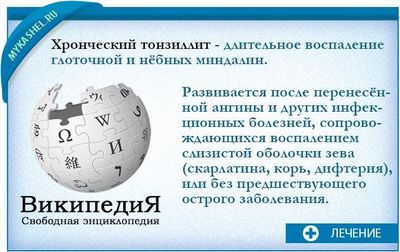 тонзиллит хронический