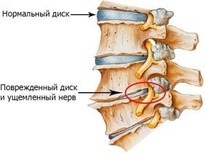 сустав