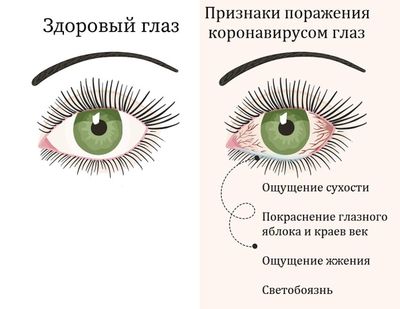 глаза и коронавирус симптомы