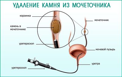 Оперативное вмешательство