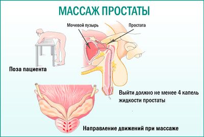 Массаж предстательной железы