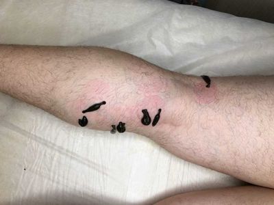 Совместимость с медикаментозным лечением