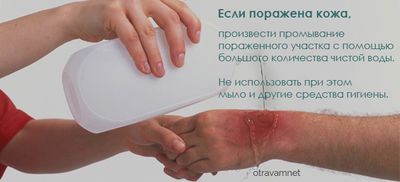 Ожог