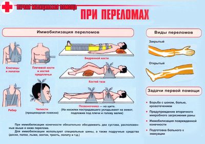 Первая помощь при переломах