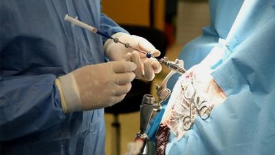 Диагностика склерозированного холангита