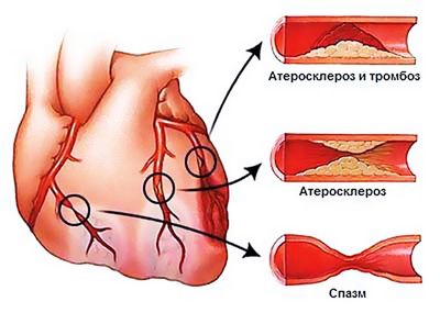 Проблемы