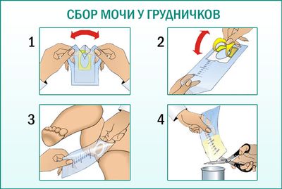 Собрать мочу у грудных детей