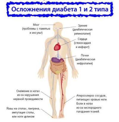 Осложнения диабета