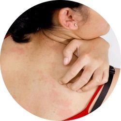 Серную мазь не рекомендуют применять длительными курсами