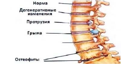 Схема