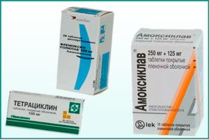 Женский уретрит: антибиотики