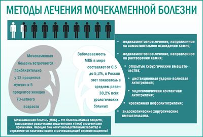 Лечение мочекаменной болезни