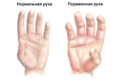 сравнение рук