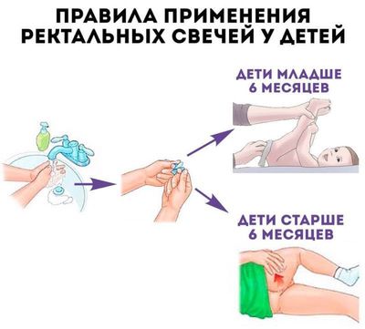 Правила введения ректальных свечей