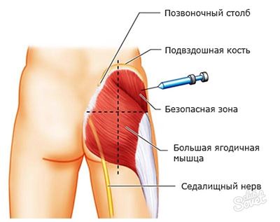 Внутримышечное введение