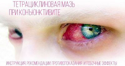 Тетрациклиновая мазь при конъюнктивите: советы и отзывы о лечении (для детей и взрослых)