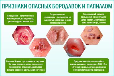 Папилломы на коже
