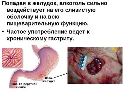 влияние на желудок