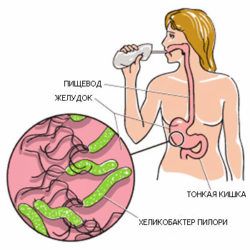 бактерии в желудке