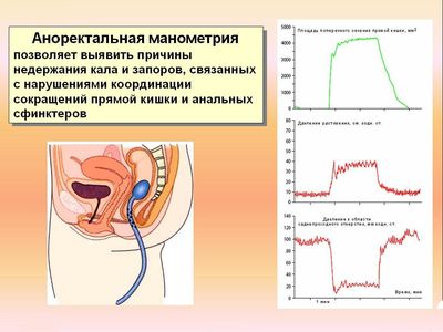 Аноректальные состояния