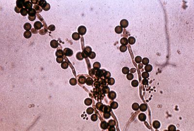 Кандида Candida albicans