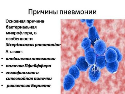 prichiny-pnevmonii