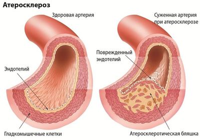 Инфографика 1