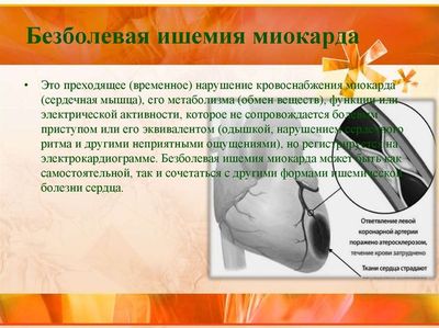 Схема 2