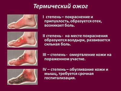 Тяжесть травмы