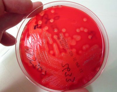 Стрептококк (Streptococcus pneumoniae)
