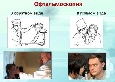 Как проводится офтальмоскопия