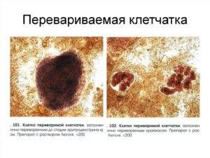 крахмал в кале у ребенка