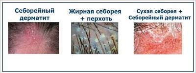 внешний вид дерматита