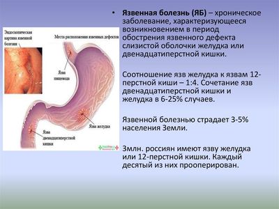 Противопоказание к использованию
