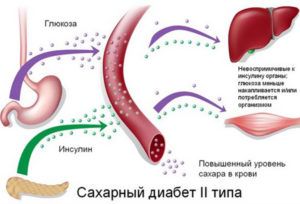 Участие печени в сахарном диабете