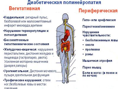 Классификация