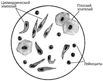 Разновидности эпителия