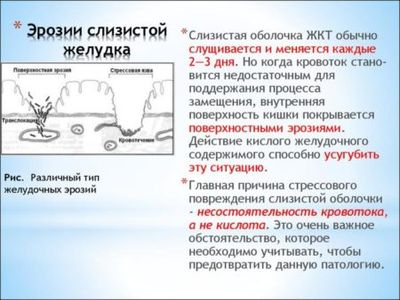 Причины эрозии