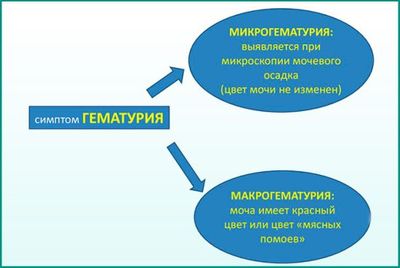 Что такое гематурия, насколько она опасна?